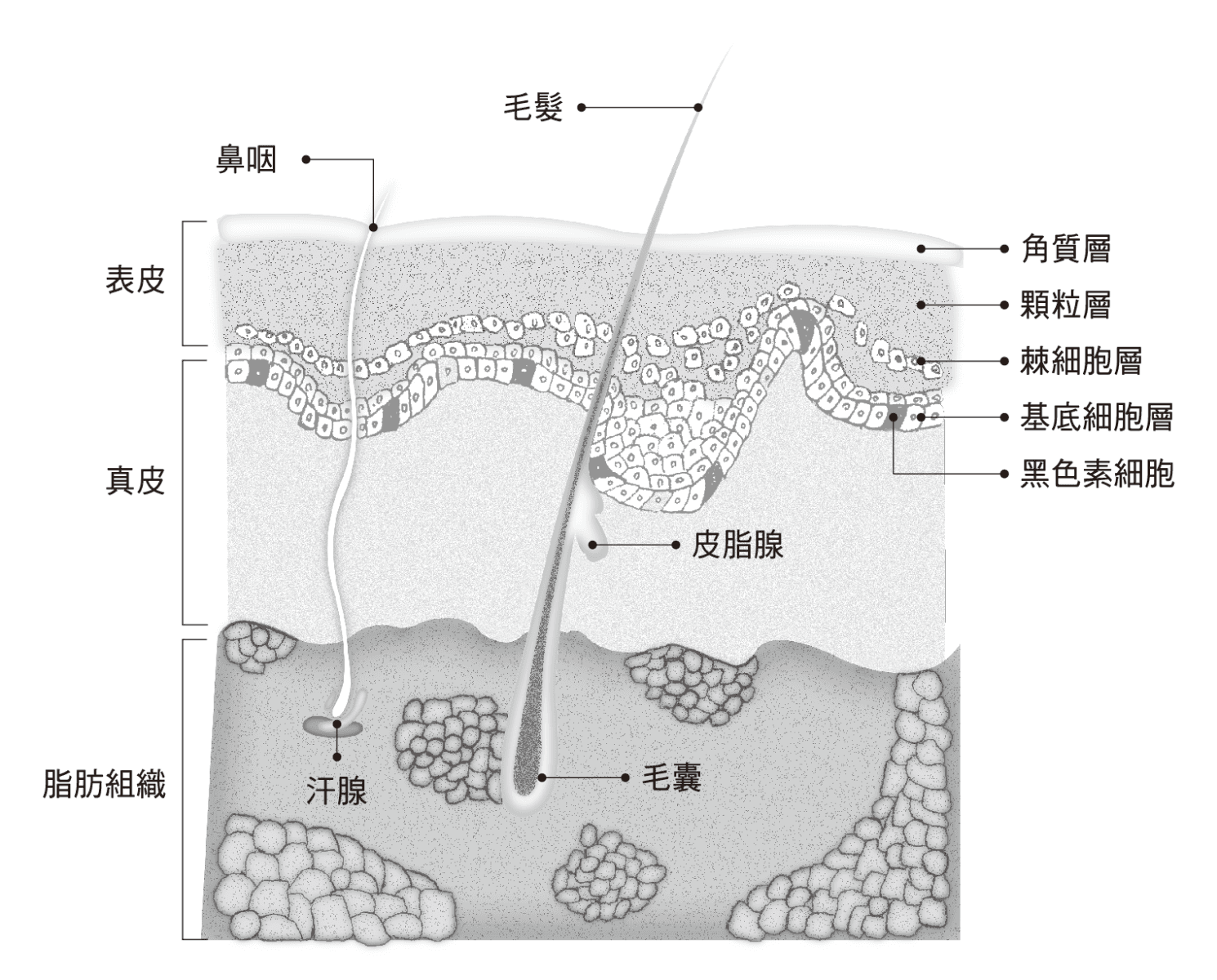 皮肤癌：成因、症状与治疗全解析