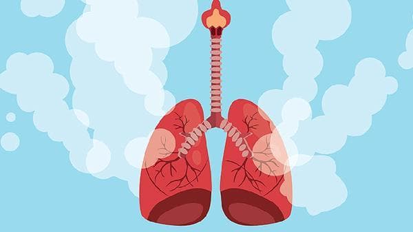 急性肺水肿处理指南：停止输液、吸氧、利尿剂联合出击！