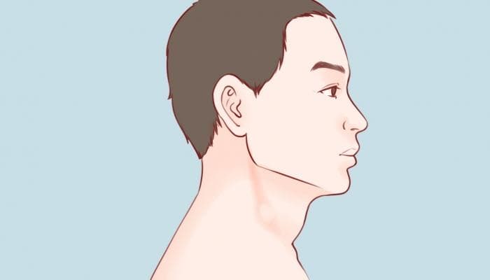 脖子后面的穴位与经络：位置、功效及作用