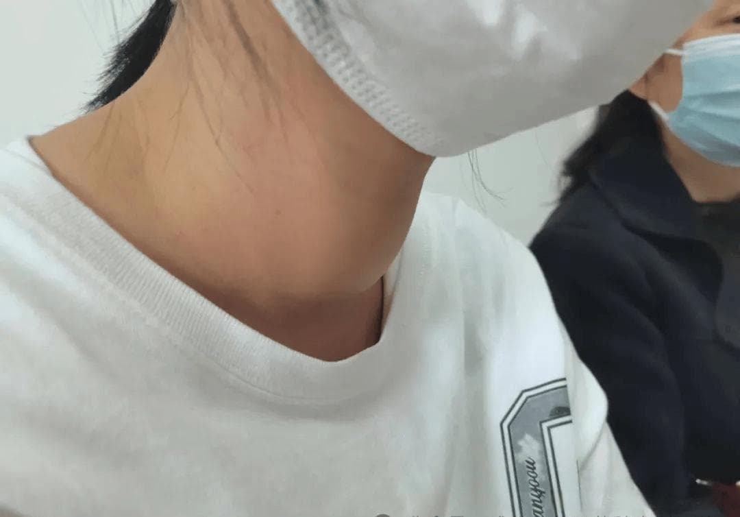 桥本甲亢和甲亢的区别在哪?
