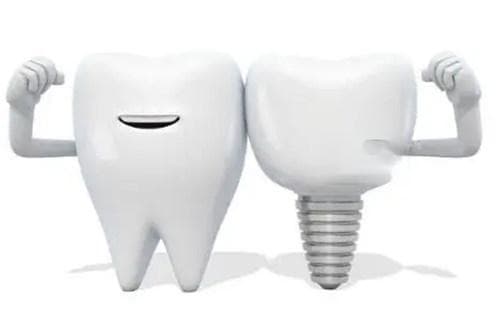 韩国登腾（Dentium）种植体有哪些特点？从多个方面详细介绍下！
