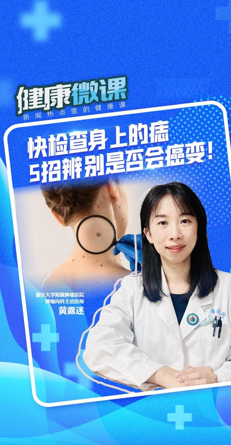 健康微课｜快检查身上的痣 5招辨别是否有可能癌变