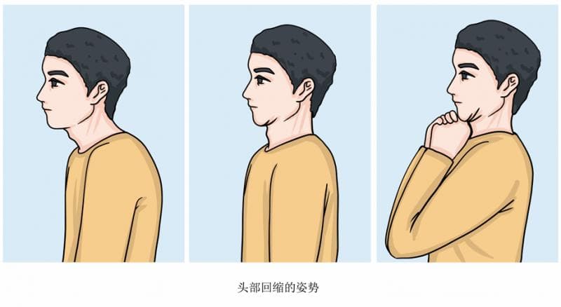 颈椎病患者有哪些康复治疗方法