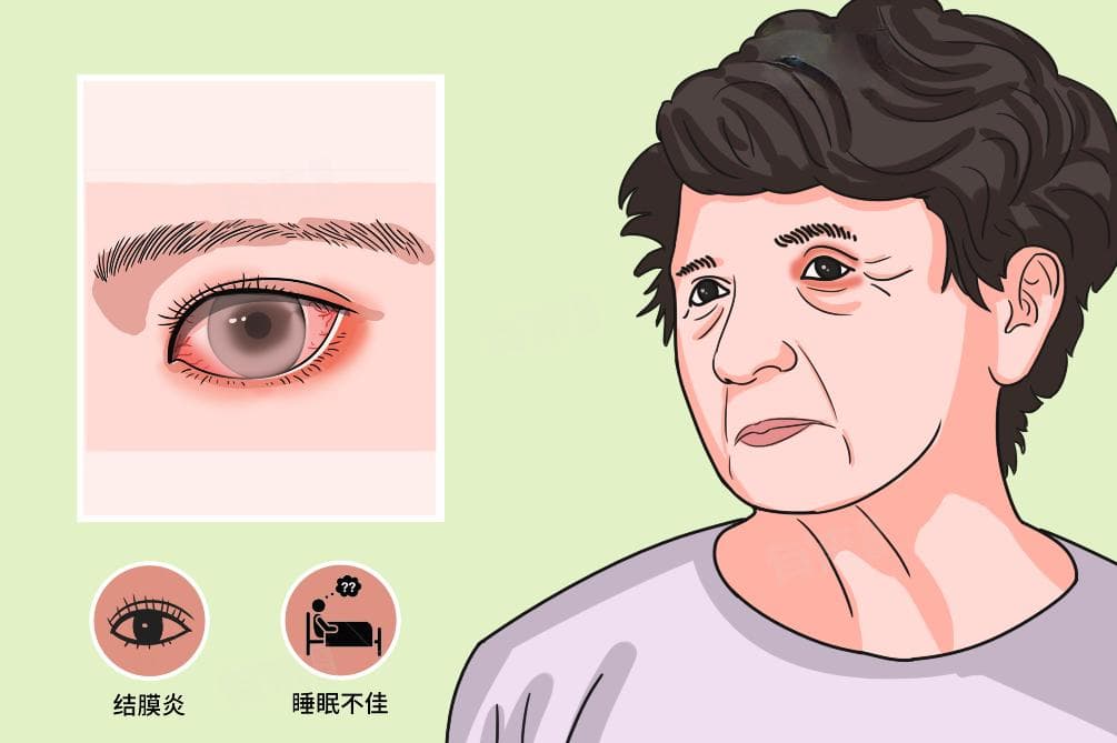 眼睑肿胀的原因及缓解方法