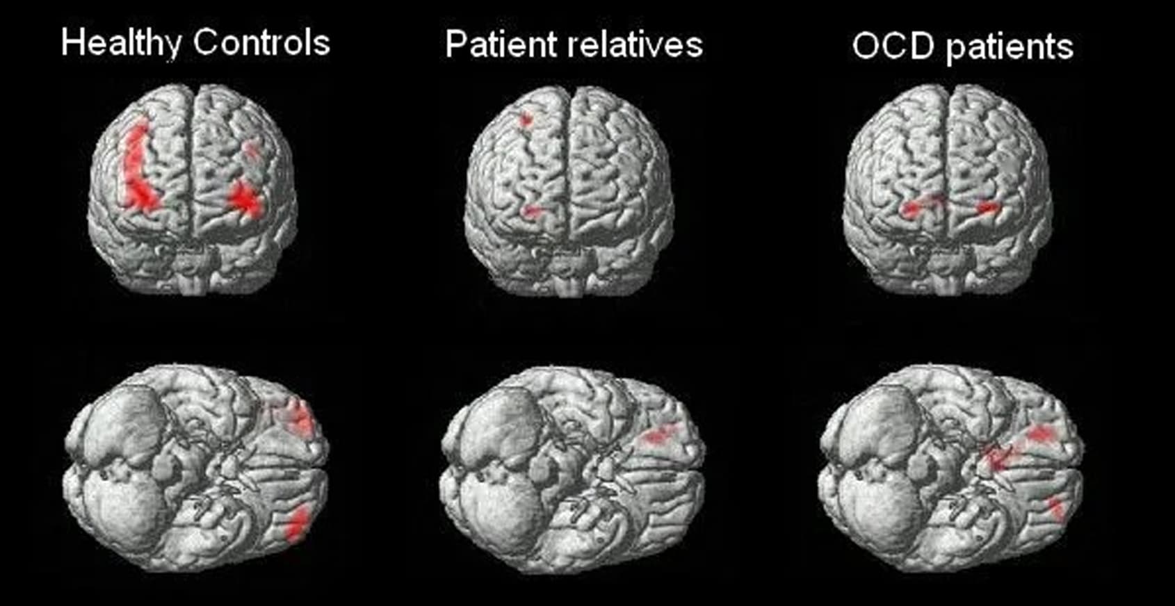 科学家发现  人类能通灵感应
