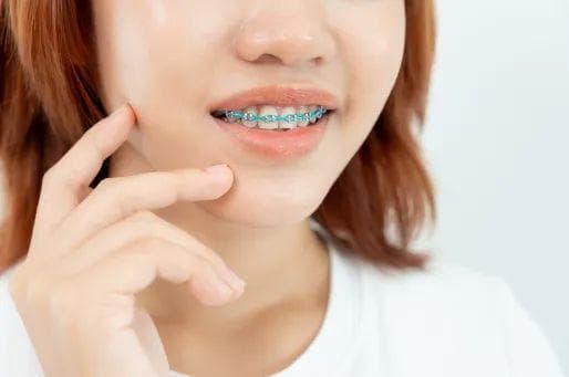 怎样确保正畸治疗的连续性？如何判断新的正畸医生是否靠谱？
