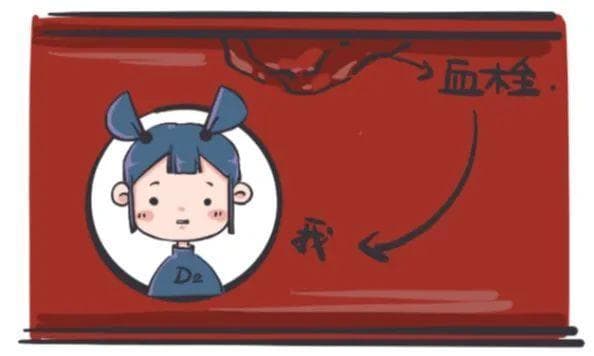 D-二聚体：敏感性高的血栓排除指标，还能预测疾病预后