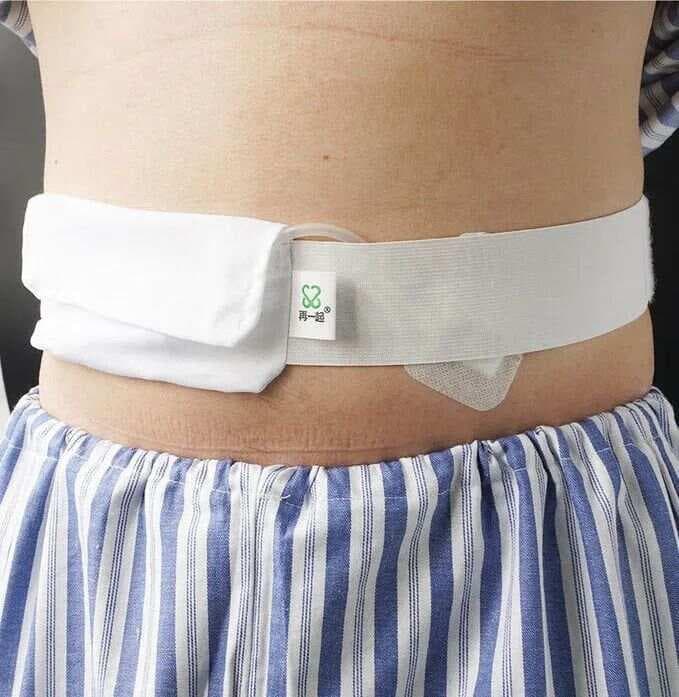 腹透管漂管如何预防和处理