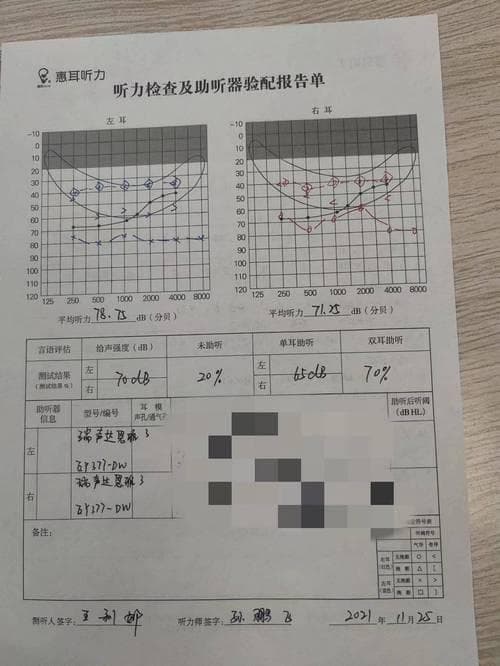 纯音听力测试如何揭示我们的听觉秘密？