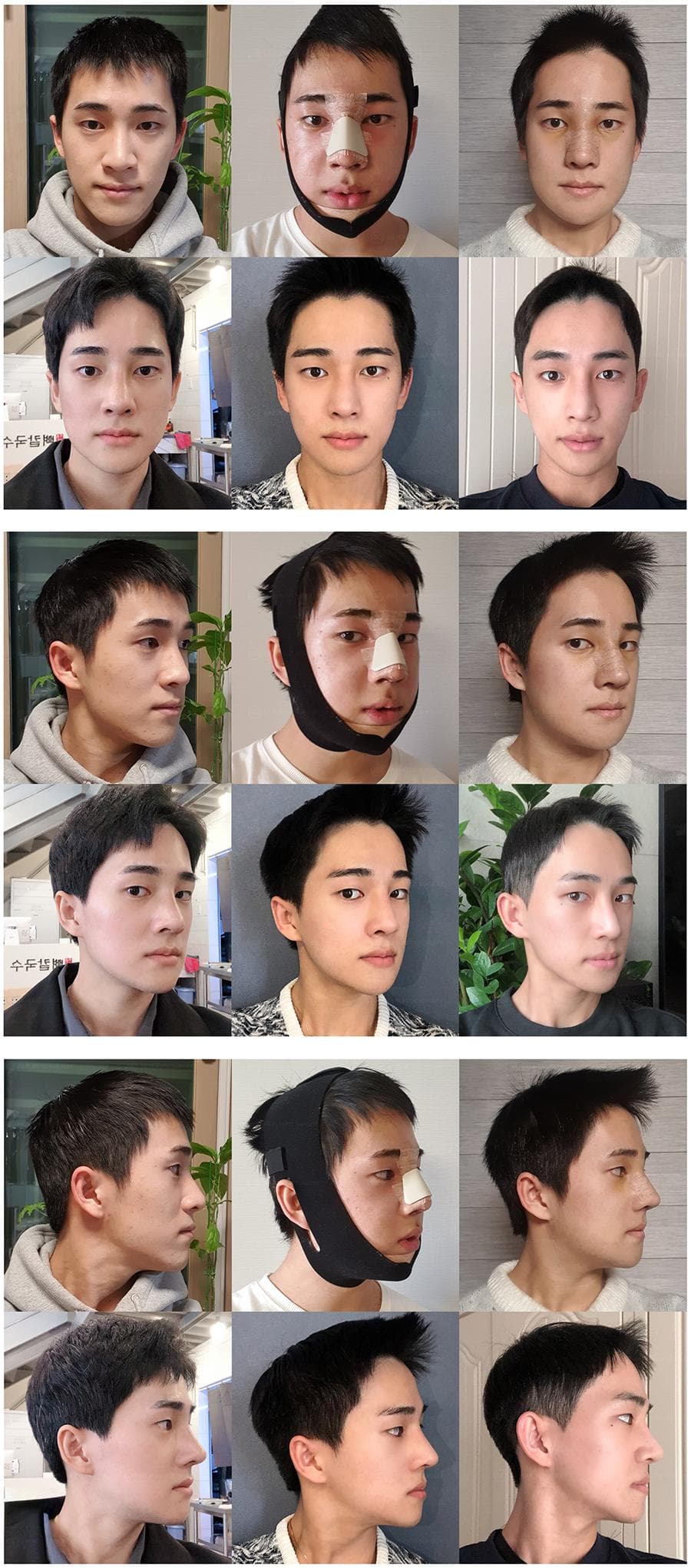 整形手术与营养补充剂：潜在风险与安全使用指南