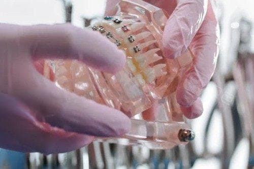 紧急止牙痛方法大合集！这些方法让你快速摆脱“要命”疼痛，不用硬扛到天亮！