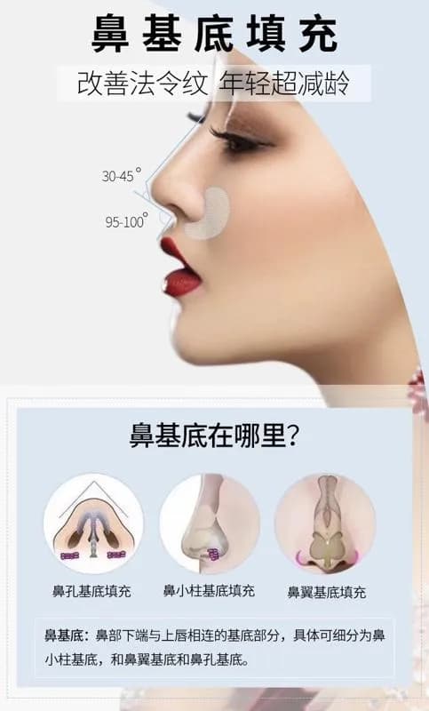 泪沟填充完全指南：三种情况下的最佳方案与材料选择