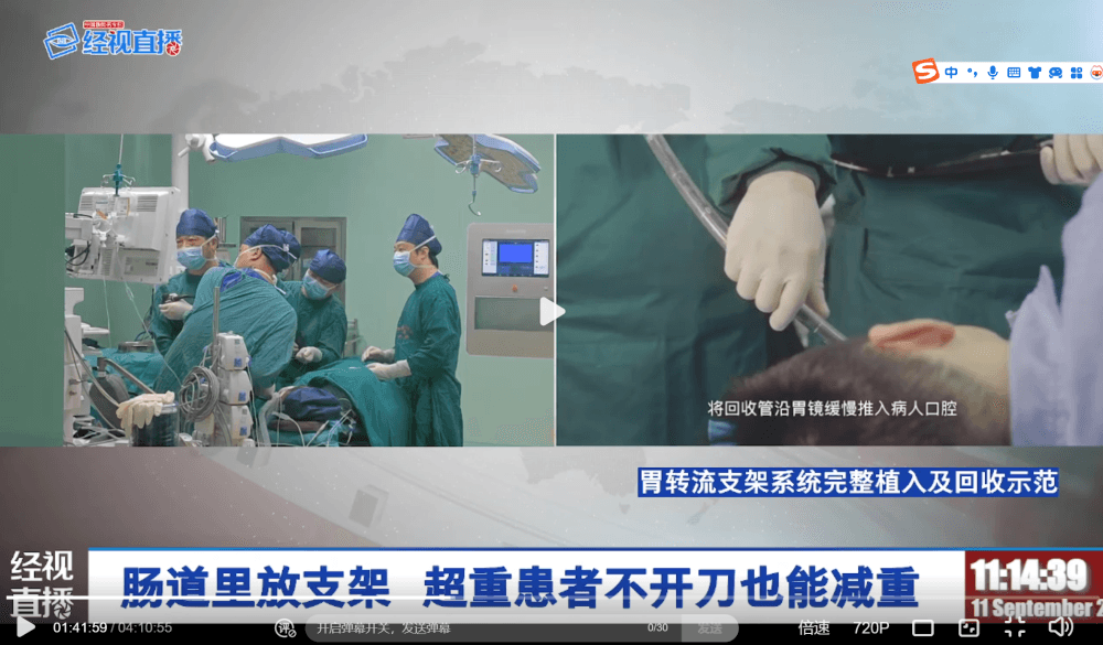 湖北首例"不开刀"减重手术：支架近3万元，术后半年内需取出，能减30到50斤