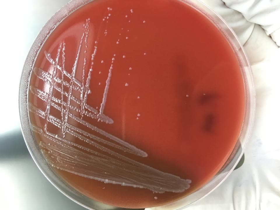 吸猫有风险，养宠物需谨慎