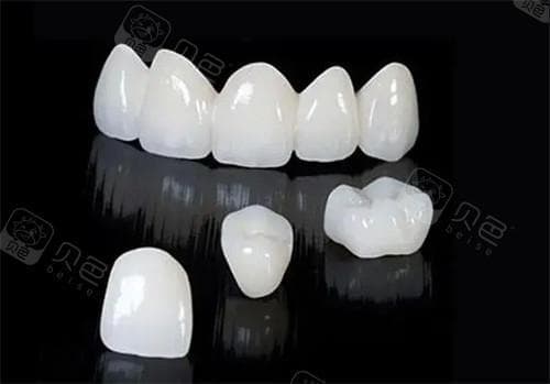 冠修复就是牙套吗？冠牙修复是什么意思？具体流程是什么？分享冠修复