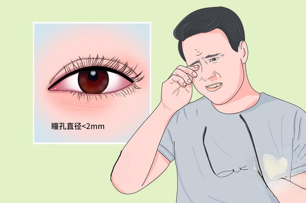 瞳孔缩小意味着什么