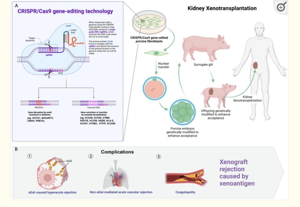 Front Immunol：中国学者---异种肾脏移植：挑战与未来方向的全面评估