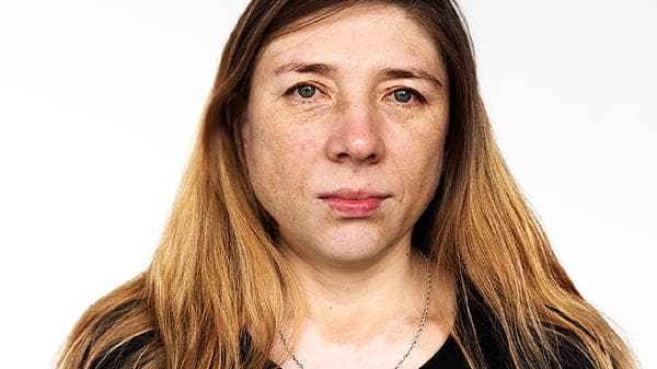 女性排尿困难原因揭秘：妊娠期、绝经后如何应对？