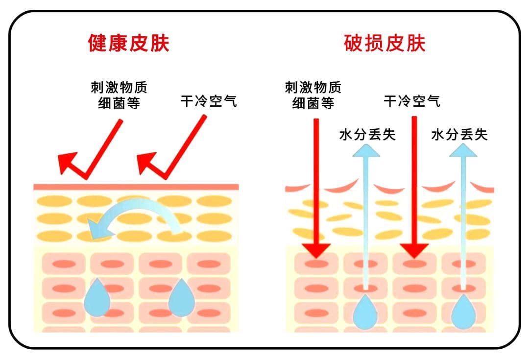 湿疹VS痱子，傻傻分不清?