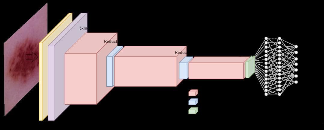 基于Inception-ResNet模型的皮肤癌分类系统实现