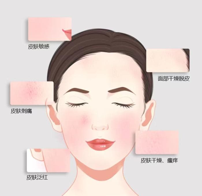 脸总是发红发烫？小心“敏感肌”找上门