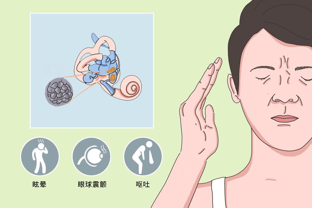 一招识别耳石症最快