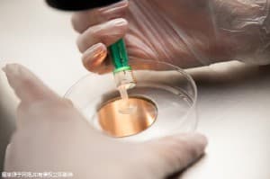 关于蚕豆病，4亿人受累的蚕豆病(G6PD缺乏症)有轻、重度之分