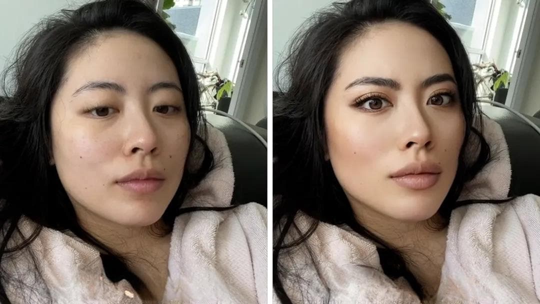 美颜滤镜如何改变了Z世代的整形口味？