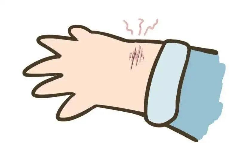 协和医生详解：常见外伤如何正确处理？