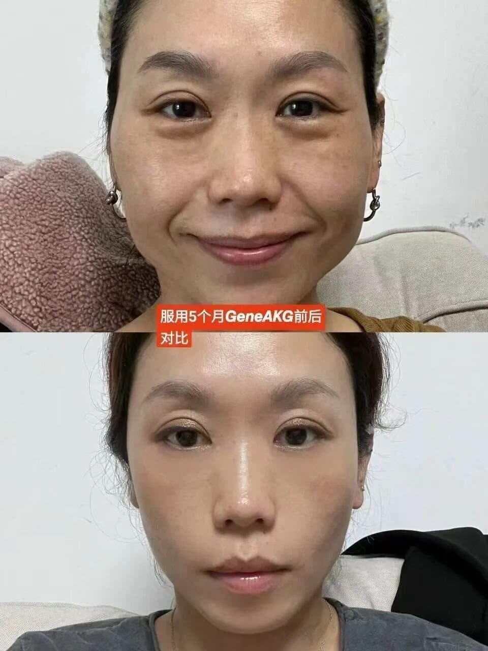 逆龄生长不是梦？基因AKG抗衰黑科技，轻松让人”重返20岁”！