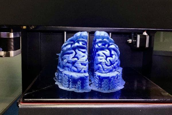 3D打印在医疗领域的革新应用与前景展望