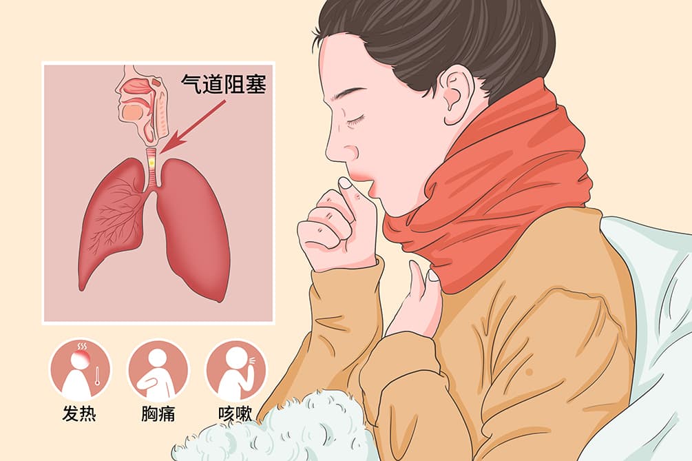 过敏呼吸困难怎么办才最有效