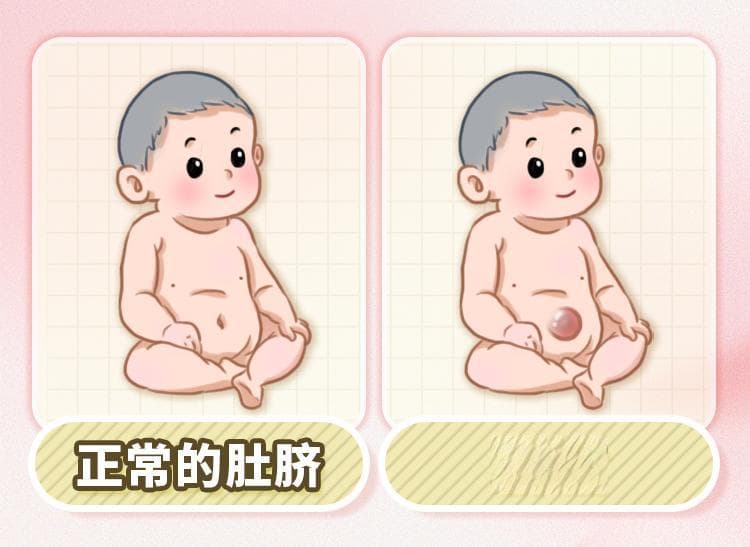 宝宝肚脐鼓鼓？这份脐疝防治手册请收好
