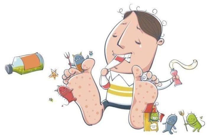 手足癣的症状、治疗方法与预防措施