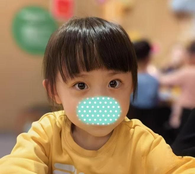 孩子拥有哪吒同款“黑眼圈”？医生提醒：可能不仅仅是“没睡好”