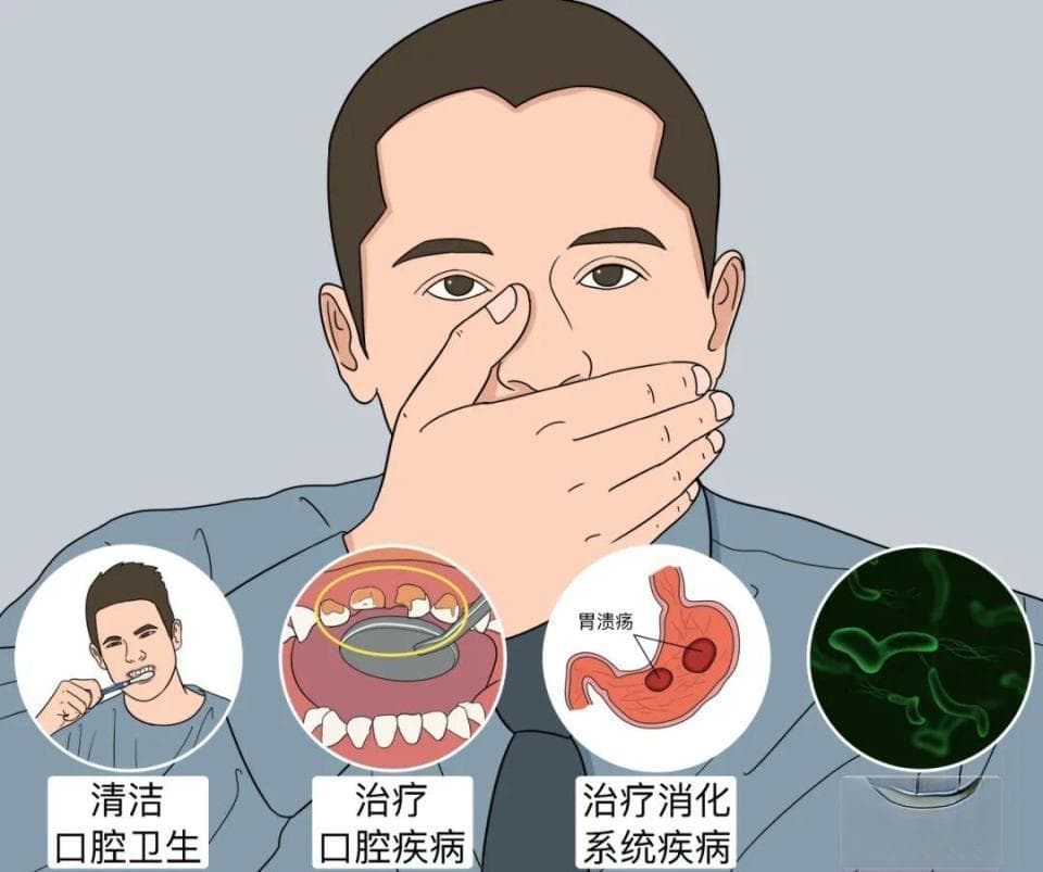 口臭的“臭源”在哪里？80%的口臭与口腔问题有关！