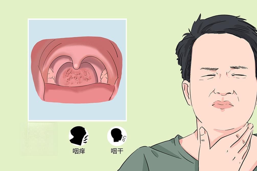 如何区分咽炎和肿瘤？从症状到检查的全面解析