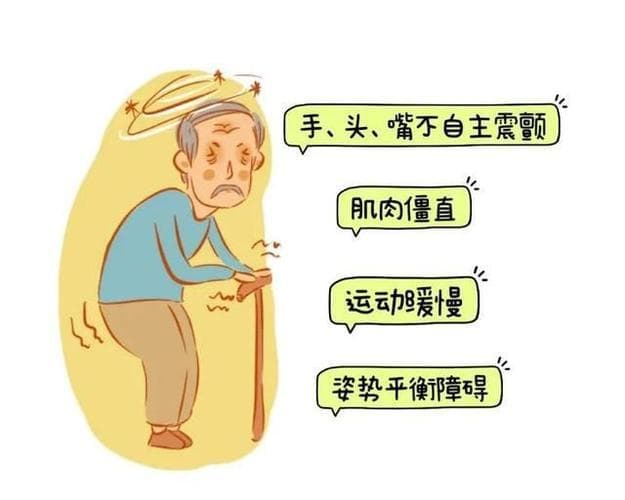 帕金森病：环境、遗传与生活方式的交织
