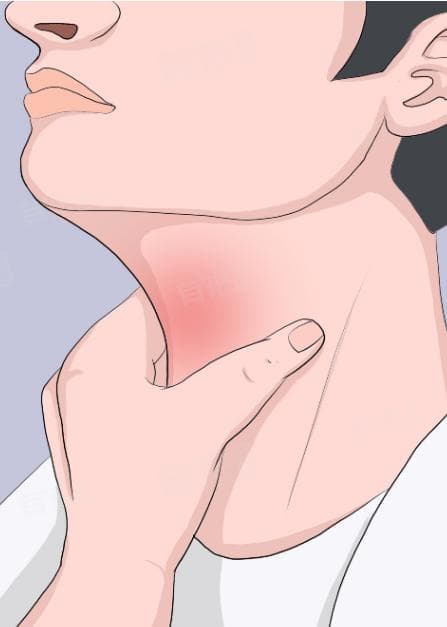 喉咙有异物感的5大表现及缓解方法