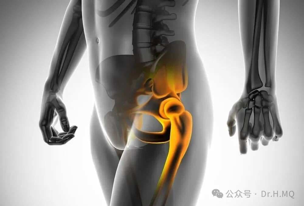 弹响髋：髋关节的“咔哒声”从何而来？