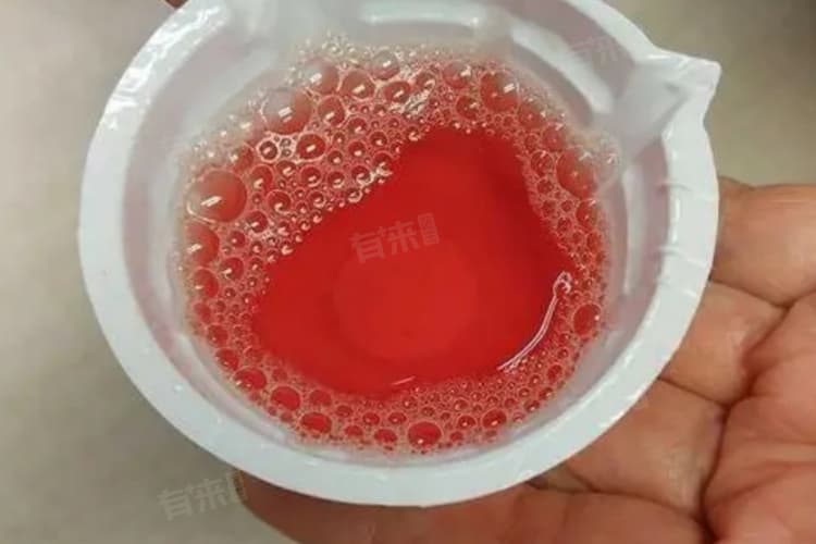 尿出淡红色的尿是什么原因
