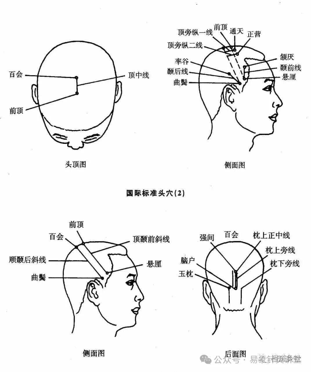 头针穴名国际标准化方案