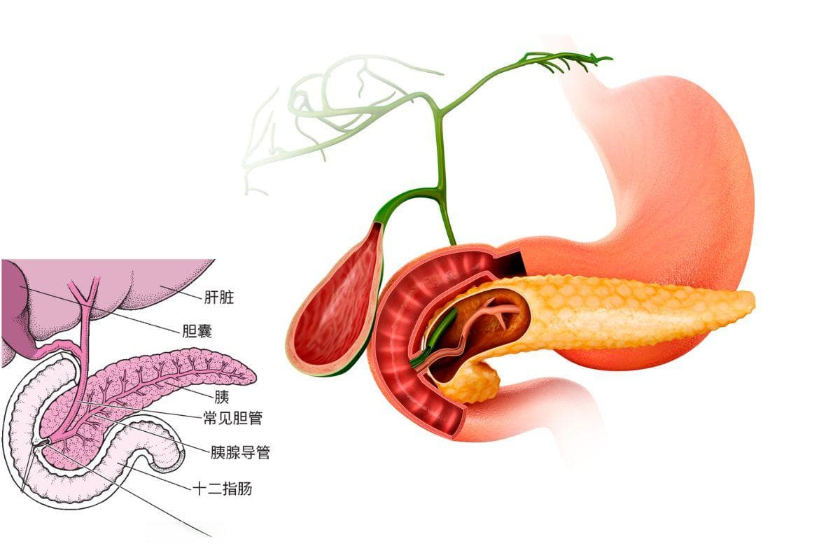 警惕这一症状 提前发现胰腺癌的关键信号