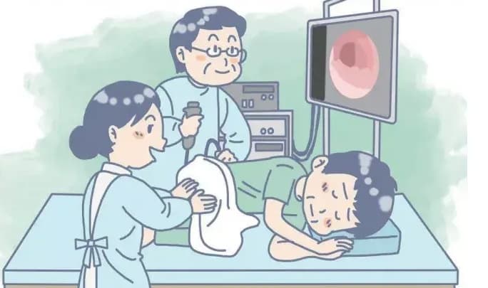 结直肠癌筛查，这些知识一定要早知道