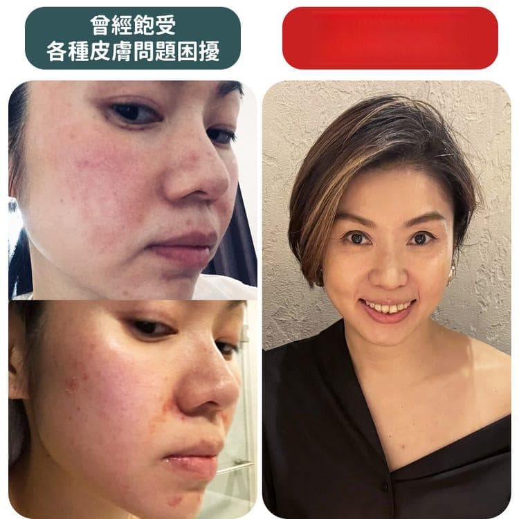 护肤如同健身：坚持“清洁保湿防晒”才能拥有健康美肌