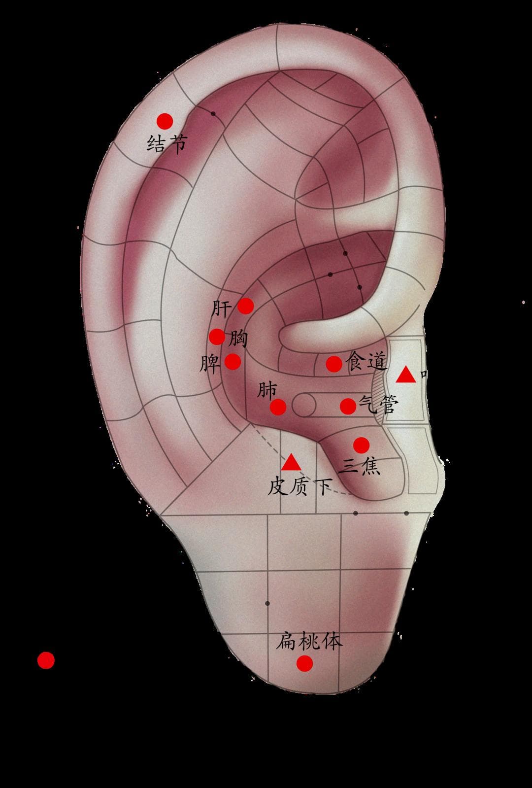 中医说——梅核气