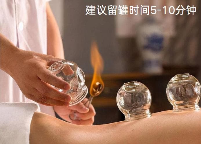 “拔罐”知多少？