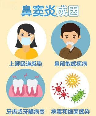 鼻窦炎：症状、诊断与治疗全解析