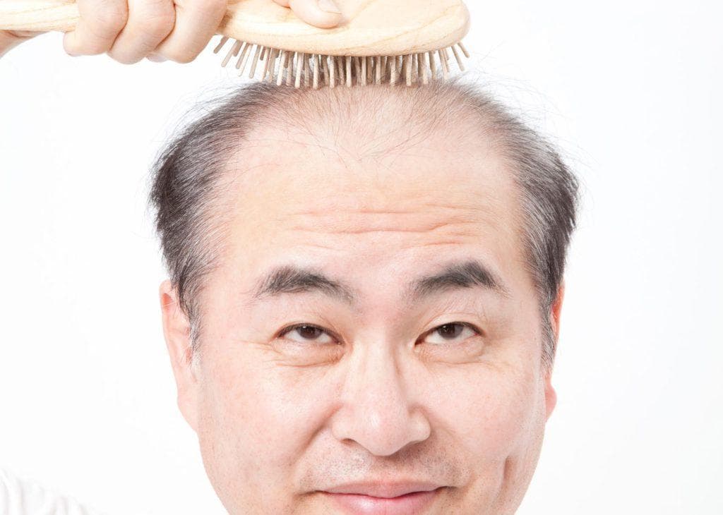 植发手术与疼痛：疼痛管理和术后护理