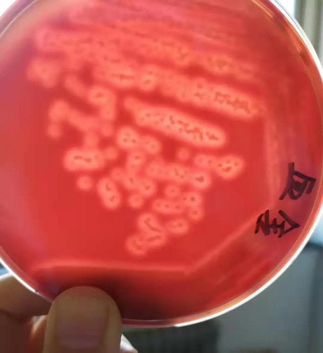 金黄色葡萄球菌检测方法详解